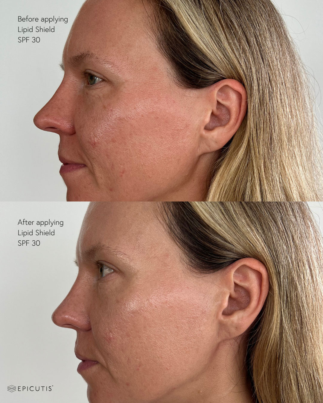 Epicutus Lipid Shield SPF 30